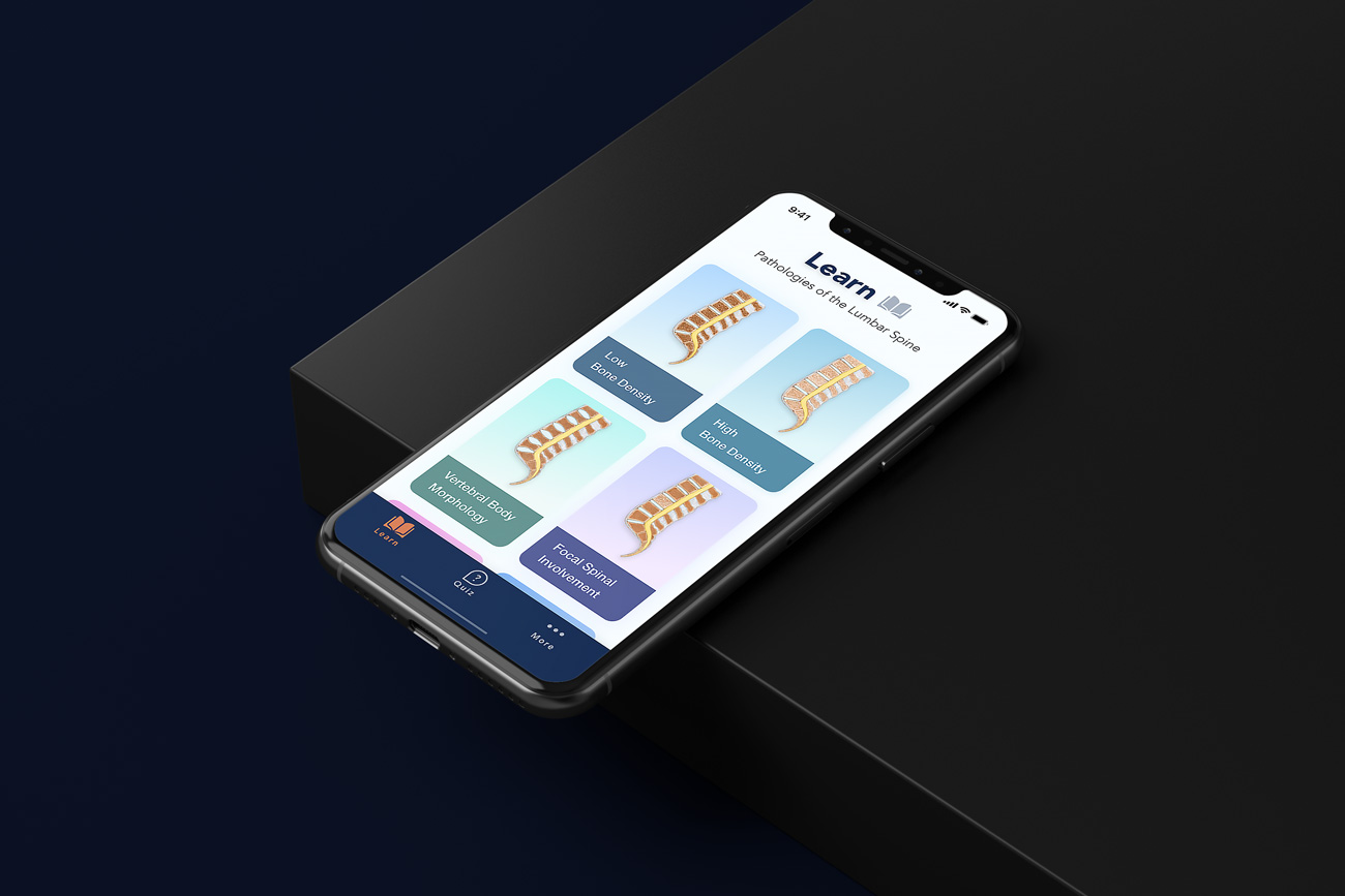 ctisus l-spine pathology app redesigned iphone sitting on black table